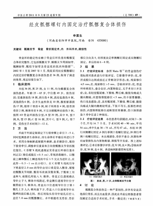 经皮骶髂螺钉内固定治疗骶髂复合体损伤