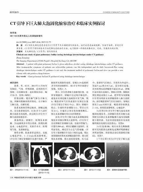 CT引导下巨大肺大泡固化缩容治疗术临床实例探讨