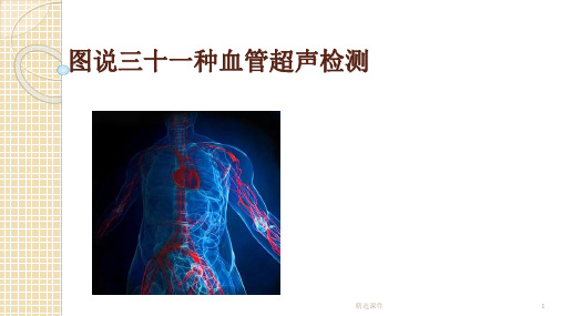 血管超声检查