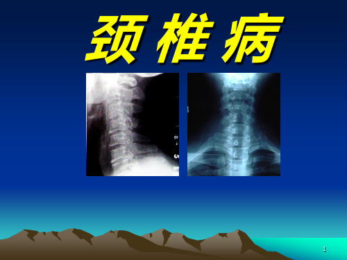 颈椎病康复治疗PPT课件