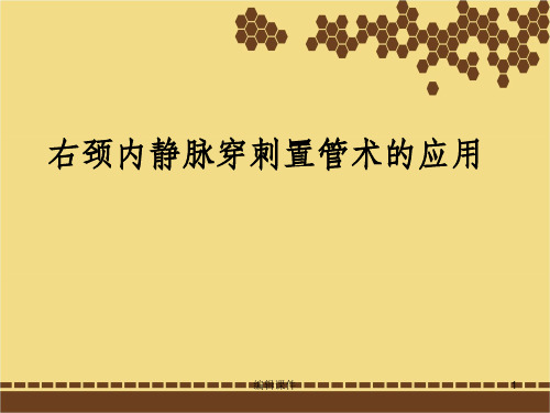 颈内静脉穿刺置管术