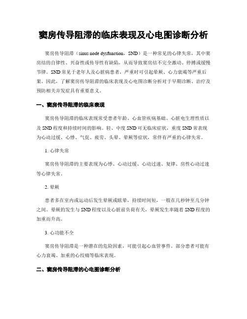 窦房传导阻滞的临床表现及心电图诊断分析