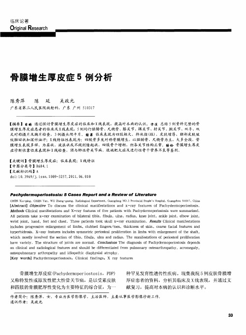骨膜增生厚皮症5例分析