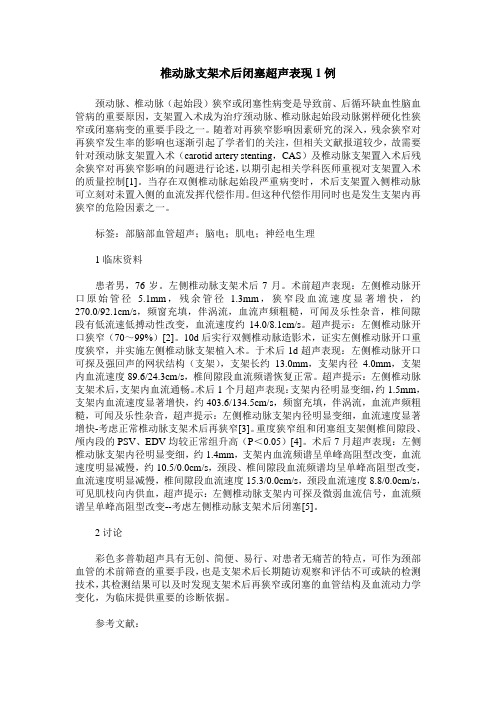椎动脉支架术后闭塞超声表现1例