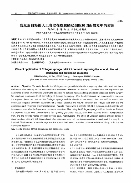 胶原蛋白海绵人工真皮在皮肤鳞状细胞癌创面修复中的应用