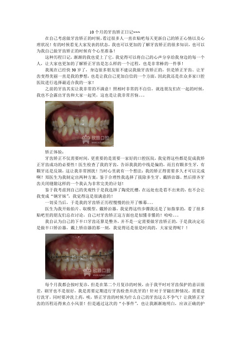 10个月的牙齿矫正日记~~~