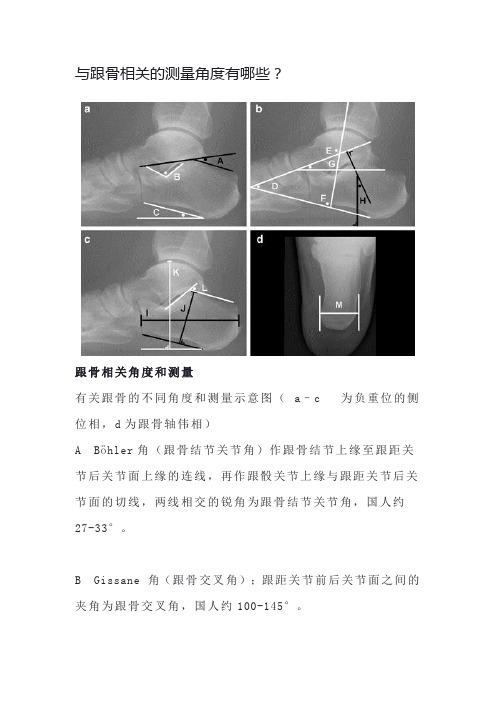 跟骨测量角