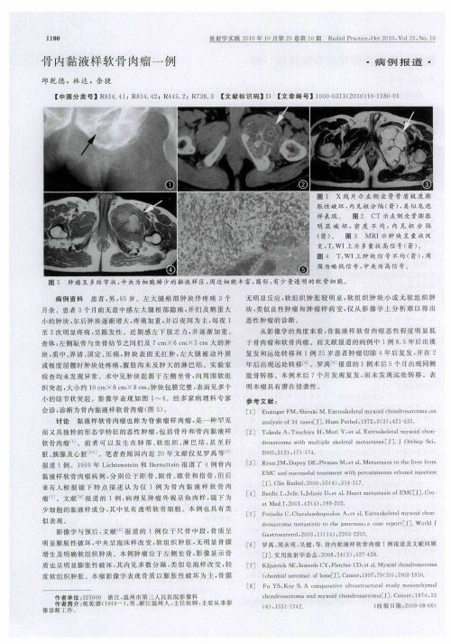 骨内黏液样软骨肉瘤一例