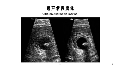 超声谐波成像