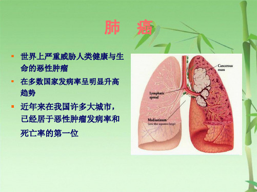 非小细胞肺癌的常用化疗方案(共37张PPT)