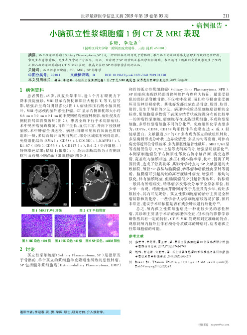 小脑孤立性浆细胞瘤1例CT及MRI表现