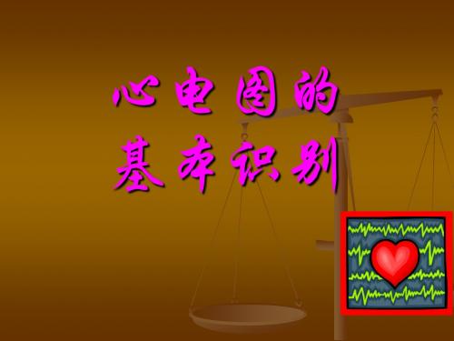 心电图的基本识别