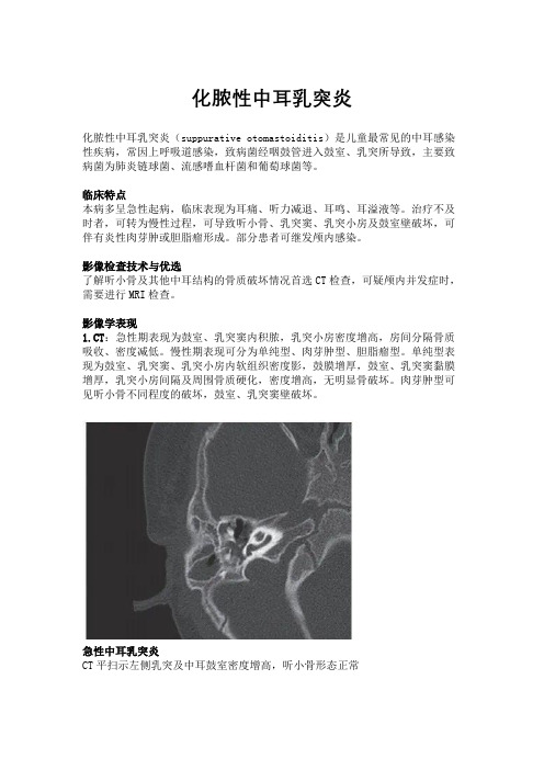 化脓性中耳乳突炎