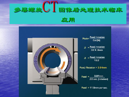 CT图像后处理技术