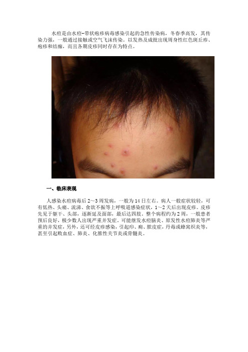水痘防治知识