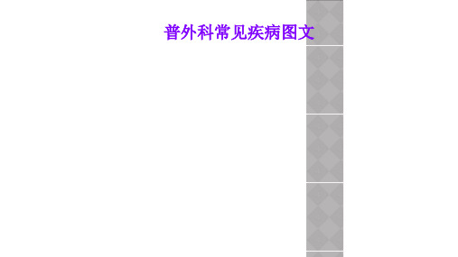普外科常见疾病图文