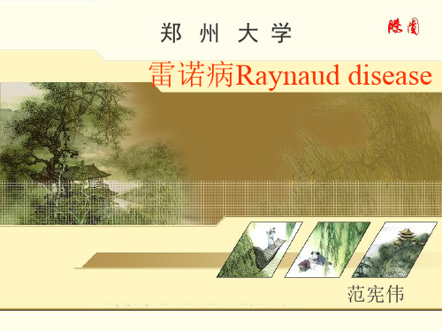 雷诺病.ppt