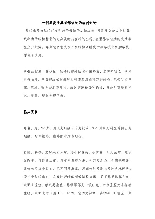 一例原发性鼻咽部结核的病例讨论