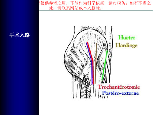 全髋关节置换手术入路培训课件