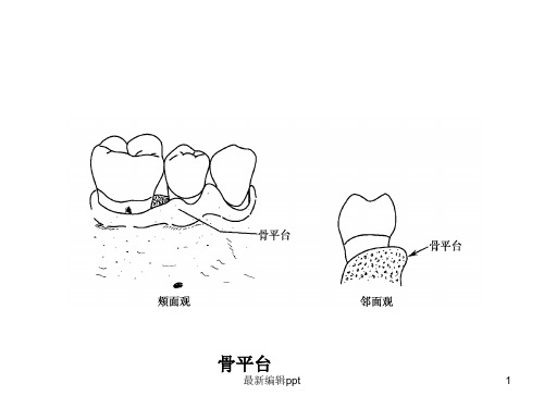 牙 周 病 学 第四版