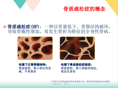 糖皮质激素性骨质疏松症的健康管理PPT.