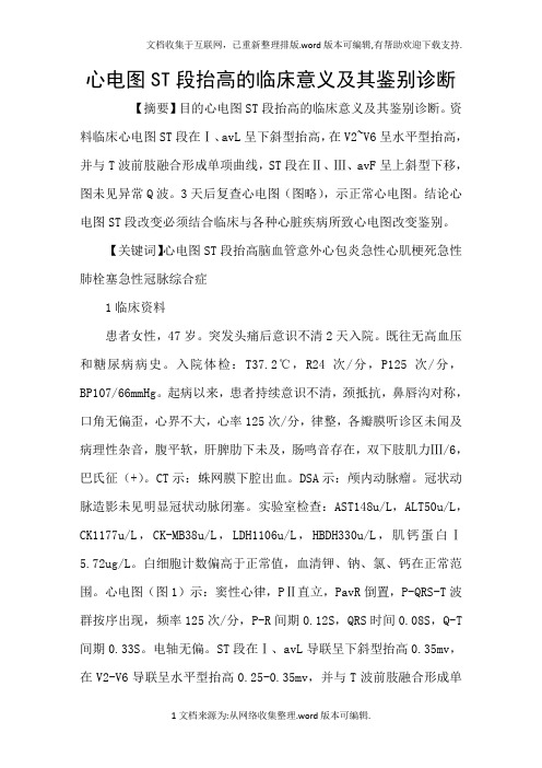 心电图ST段抬高的临床意义及其鉴别诊断