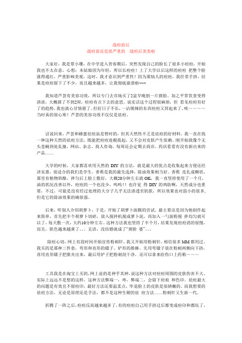 覃小珊与痘痘的血泪斗争史