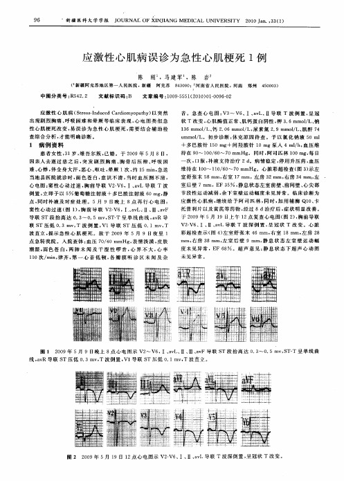 应激性心肌病误诊为急性心肌梗死1例