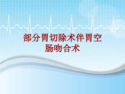 外科手术教学资料：部分胃切除术伴胃空肠吻合术讲解模板