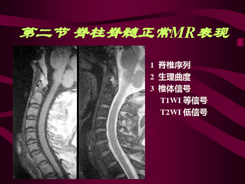 脊髓病变的影像诊断