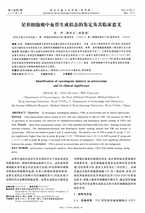 星形细胞瘤中血管生成拟态的鉴定及其临床意义