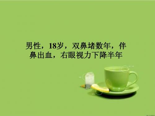 鼻咽部纤维血管瘤病
