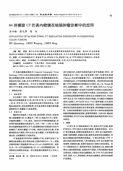 64排螺旋CT仿真内窥镜在结肠肿瘤诊断中的应用