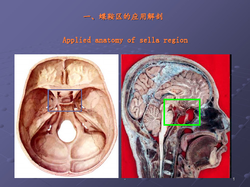 蝶鞍区断层解剖与影像对照ppt课件