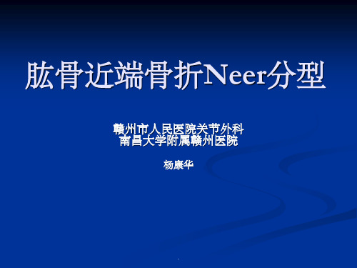 肱骨近端骨折Neer分型及治疗