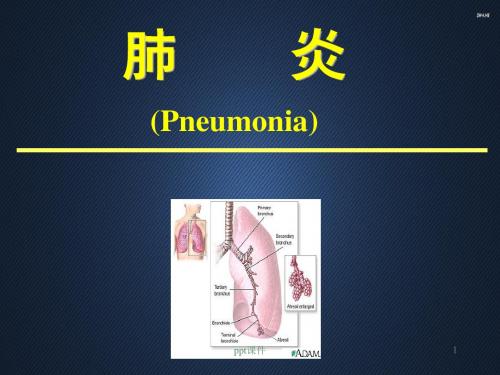支气管肺炎  ppt课件