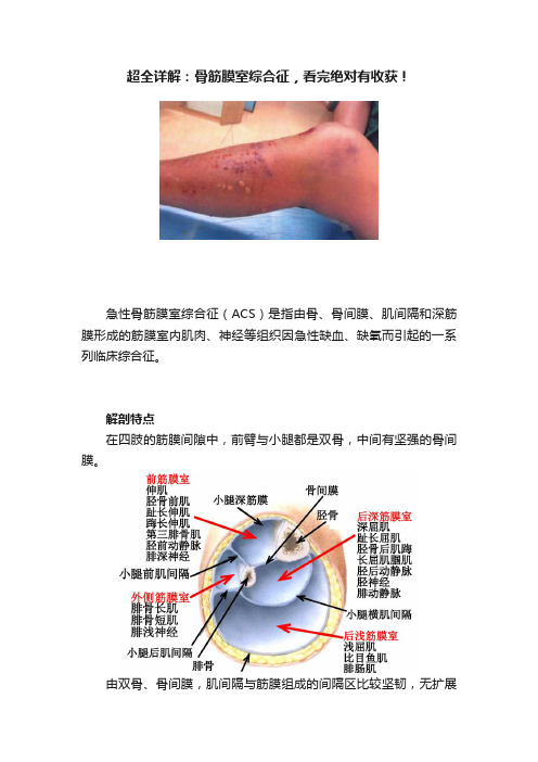 超全详解：骨筋膜室综合征，看完绝对有收获！