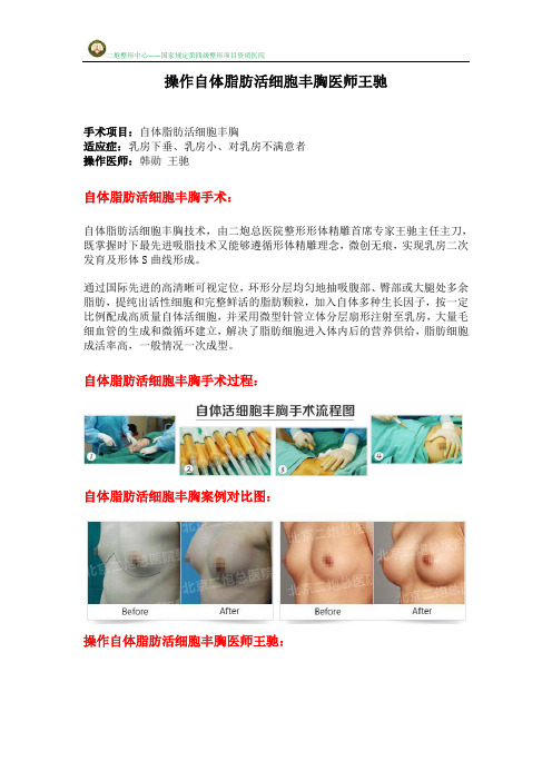 操作自体脂肪活细胞丰胸【医师王驰】