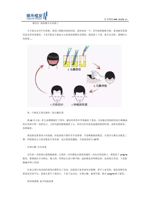 植发给自身带来的改变真是不小