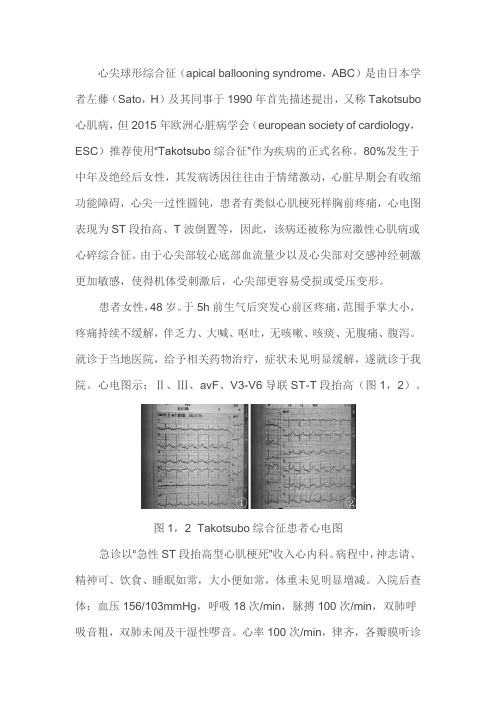 心尖球形综合征