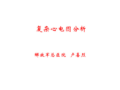 复杂心电图分析