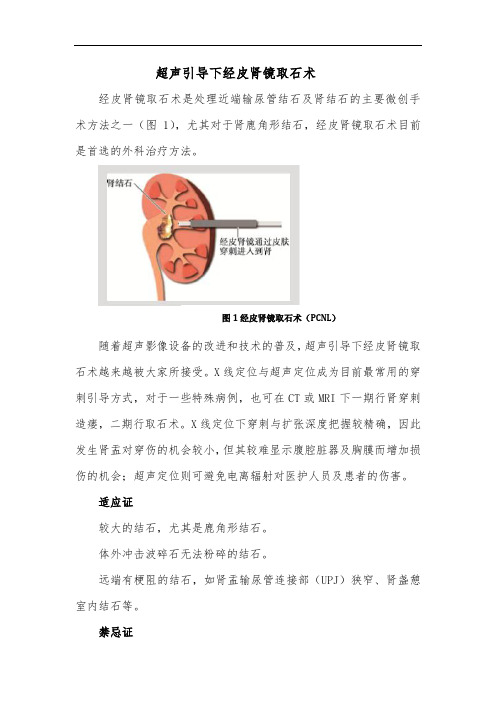 超声引导下经皮肾镜取石术
