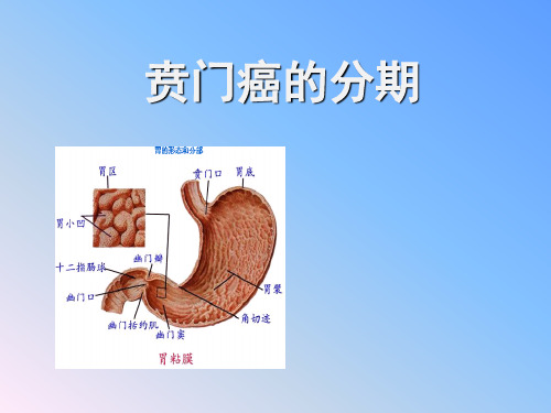 贲门癌的分期