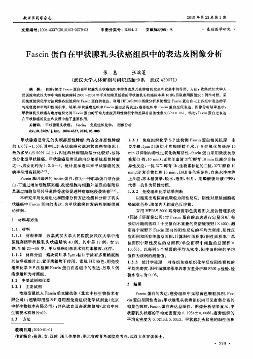 Fascin蛋白在甲状腺乳头状癌组织中的表达及图像分析