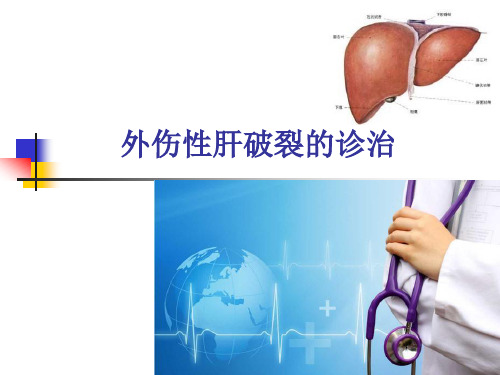 外伤性肝破裂的诊治