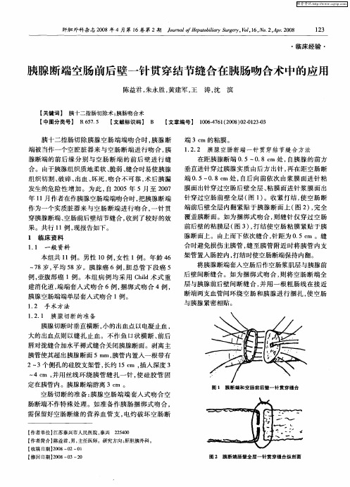 胰腺断端空肠前后壁一针贯穿结节缝合在胰肠吻合术中的应用