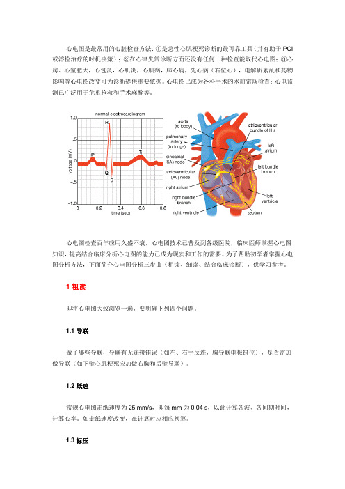 心电图分析三步曲
