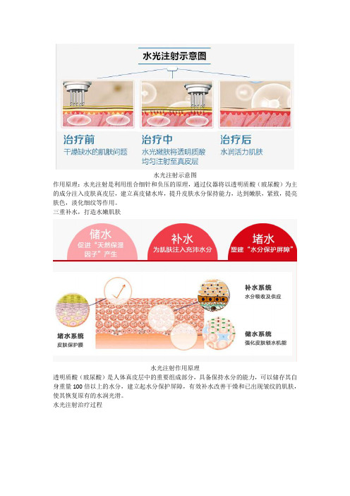 水光注射的治疗原理解析