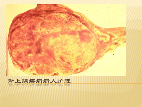 肾上腺疾病病人护理