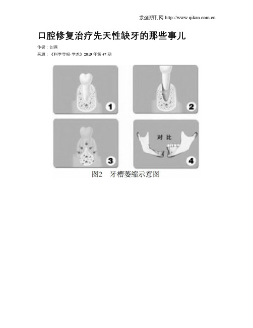 口腔修复治疗先天性缺牙的那些事儿